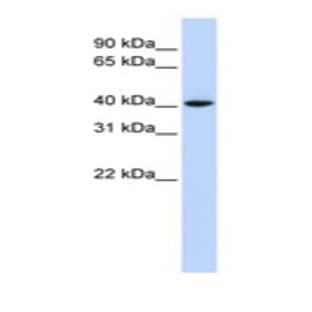 anti-Cyclin D1 (CCND1) (Internal Region) antibody avatar