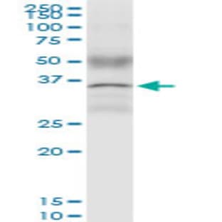 anti-Cyclin D1 (CCND1) (AA 1-295) antibody avatar