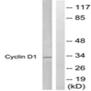 anti-Cyclin D1 (CCND1) (AA 246-295) antibody avatar