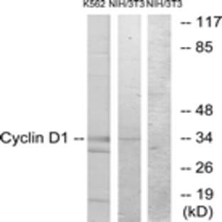 anti-Cyclin D1 (CCND1) (AA 56-105) antibody avatar