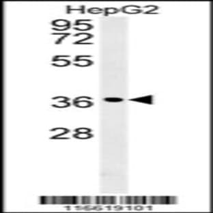 anti-Cyclin D1 (CCND1) (AA 203-238), (Tyr226) antibody avatar
