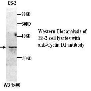 anti-Cyclin D1 (CCND1) (C-Term) antibody avatar