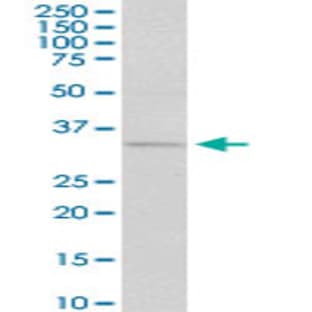 anti-Cyclin D1 (CCND1) (AA 1-295) antibody avatar