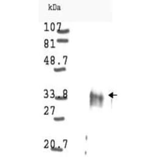 anti-Cyclin D1 (CCND1) antibody avatar