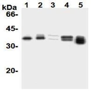 anti-Cyclin D1 (CCND1) antibody avatar
