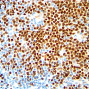 anti-Cyclin D1 (CCND1) (C-Term), (AA 250-295) antibody avatar