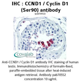 anti-Cyclin D1 (CCND1) (Ser90) antibody avatar