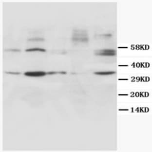 anti-Cyclin D1 (CCND1) antibody avatar