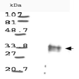 anti-Cyclin D1 (CCND1) antibody avatar