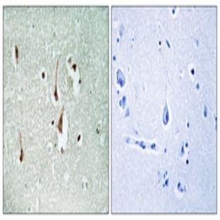 anti-Cyclin D1 (CCND1) antibody avatar