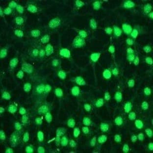 anti-Cyclin D1 (CCND1) (N-Term), (AA 1-50) antibody avatar
