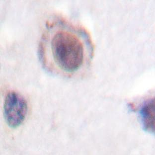 anti-Cyclin D1 (CCND1) antibody avatar