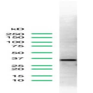 anti-Cyclin D1 (CCND1) (C-Term) antibody avatar