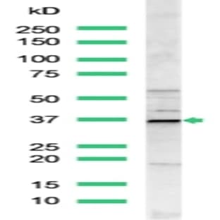 anti-Cyclin D1 (CCND1) (C-Term) antibody avatar