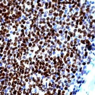 anti-Cyclin D1 (CCND1) (C-Term) antibody avatar