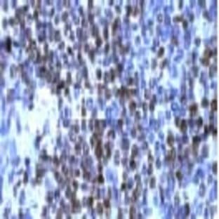 anti-Cyclin D1 (CCND1) (C-Term) antibody avatar