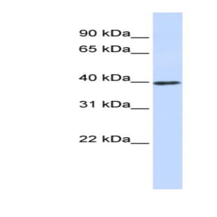 anti-Cyclin D1 (CCND1) (Middle Region) antibody avatar