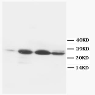 anti-B-Cell CLL/lymphoma 2 (BCL2) (AA 41-54) antibody avatar