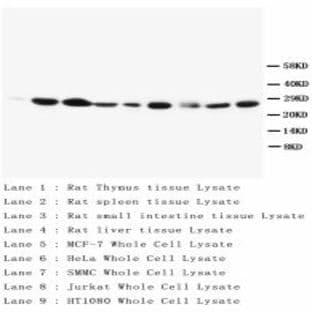 anti-B-Cell CLL/lymphoma 2 (BCL2) (AA 41-54) antibody avatar