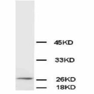 anti-B-Cell CLL/lymphoma 2 (BCL2) (AA 41-54) antibody avatar