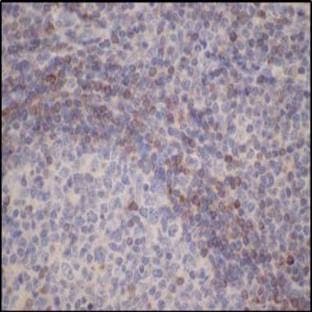 anti-B-Cell CLL/lymphoma 2 (BCL2) (N-Term) antibody avatar