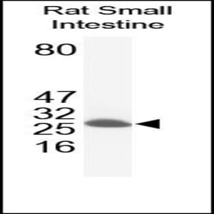 anti-B-Cell CLL/lymphoma 2 (BCL2) (N-Term) antibody avatar
