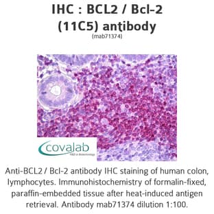 anti-B-Cell CLL/lymphoma 2 (BCL2) antibody