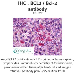 anti-B-Cell CLL/lymphoma 2 (BCL2) (AA 1-211) antibody avatar