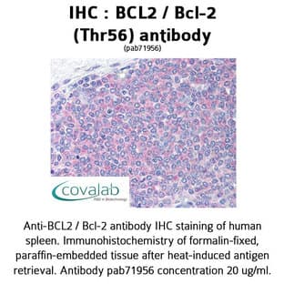anti-B-Cell CLL/lymphoma 2 (BCL2) (Thr56) antibody avatar