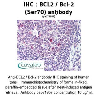 anti-B-Cell CLL/lymphoma 2 (BCL2) (Ser70) antibody avatar