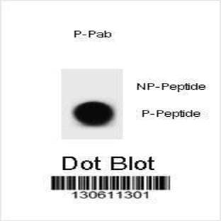 anti-B-Cell CLL/lymphoma 2 (BCL2) (pThr56) antibody avatar