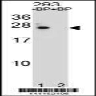 anti-B-Cell CLL/lymphoma 2 (BCL2) (Center), (AA 87-116) antibody avatar