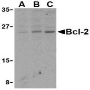 anti-B-Cell CLL/lymphoma 2 (BCL2) (N-Term) antibody avatar
