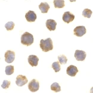 anti-B-Cell CLL/lymphoma 2 (BCL2) antibody avatar