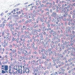 anti-B-Cell CLL/lymphoma 2 (BCL2) (Thr56) antibody avatar