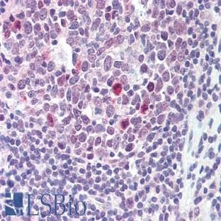 anti-B-Cell CLL/lymphoma 2 (BCL2) (Ser70) antibody avatar