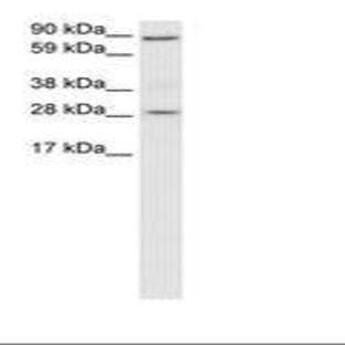 anti-B-Cell CLL/lymphoma 2 (BCL2) (N-Term) antibody avatar