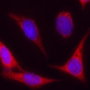 anti-B-Cell CLL/lymphoma 2 (BCL2) (N-Term) antibody avatar