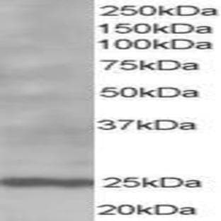 anti-B-Cell CLL/lymphoma 2 (BCL2) (N-Term) antibody avatar