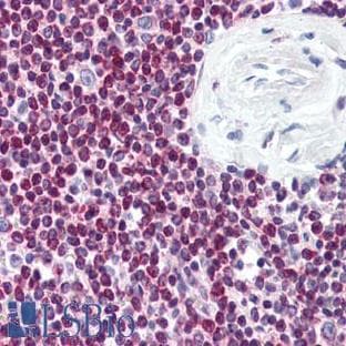 anti-B-Cell CLL/lymphoma 2 (BCL2) (AA 41-54) antibody avatar