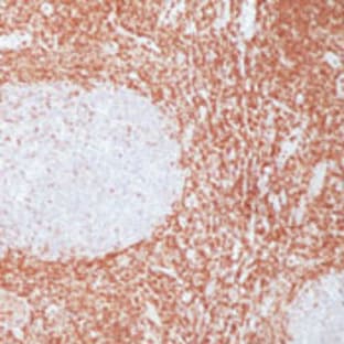 anti-B-Cell CLL/lymphoma 2 (BCL2) antibody avatar