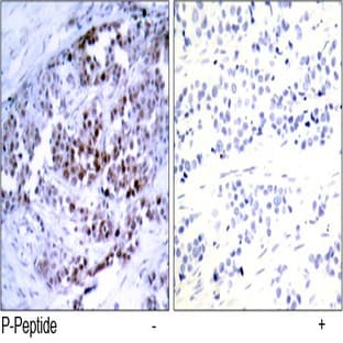 anti-B-Cell CLL/lymphoma 2 (BCL2) (pSer70) antibody avatar
