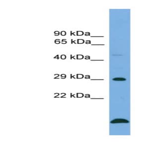 anti-B-Cell CLL/lymphoma 2 (BCL2) (Middle Region) antibody avatar