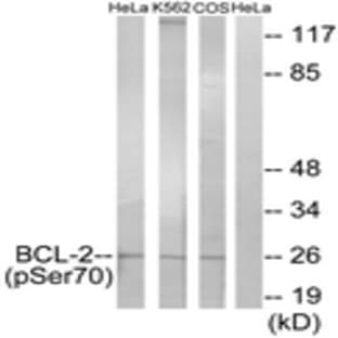 anti-B-Cell CLL/lymphoma 2 (BCL2) (pSer70) antibody avatar