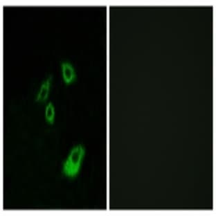 anti-B-Cell CLL/lymphoma 2 (BCL2) (pThr56) antibody avatar