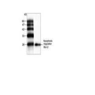 anti-B-Cell CLL/lymphoma 2 (BCL2) (AA 1-195) antibody avatar