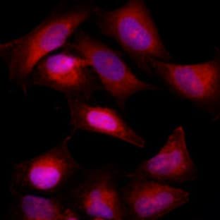 anti-B-Cell CLL/lymphoma 2 (BCL2) antibody avatar