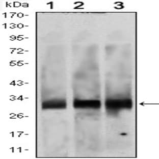 anti-B-Cell CLL/lymphoma 2 (BCL2) antibody avatar