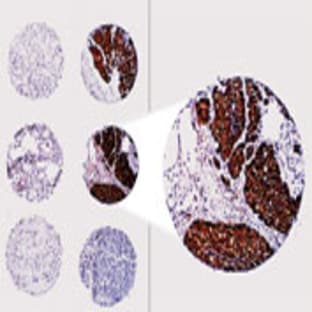 anti-B-Cell CLL/lymphoma 2 (BCL2) (AA 61-76) antibody avatar