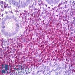 anti-B-Cell CLL/lymphoma 2 (BCL2) antibody avatar
